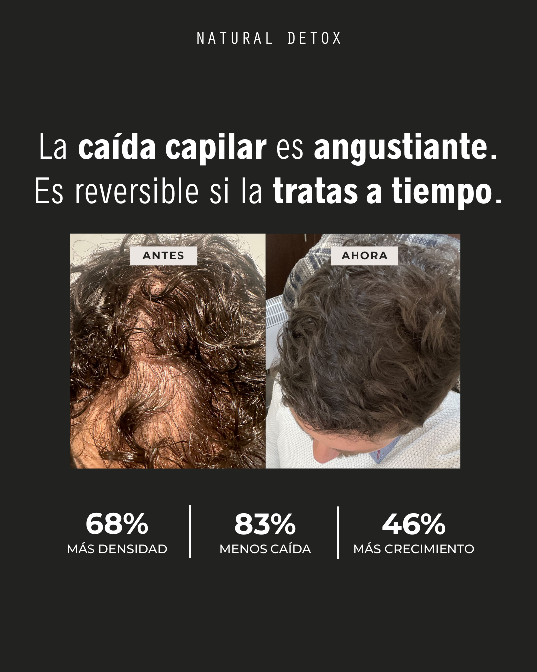 Tónico Anticaída